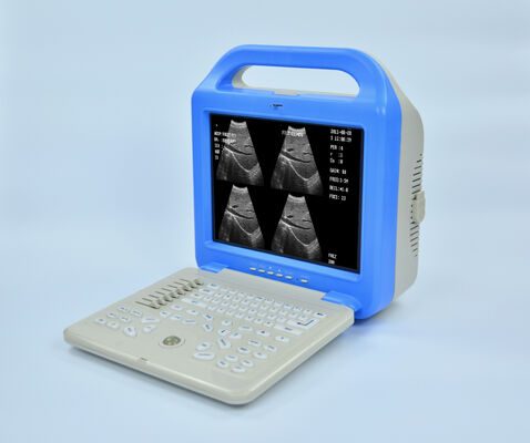 Digital Laptop Ultrasonic  Diagnosis  Equipment to Human