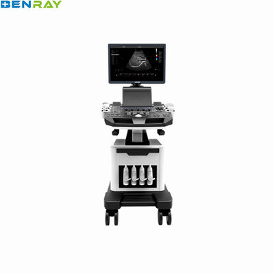 ट्रॉली रंग डॉपलर अल्ट्रासाउंड डायग्नोस्टिक सिस्टम
